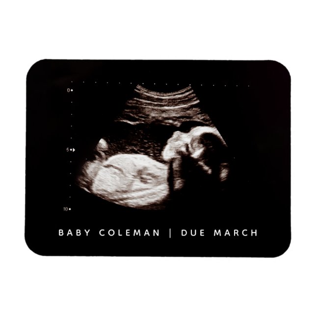 Pregnancy Announcement Baby Sonogram Photo Magnet (Horizontal)