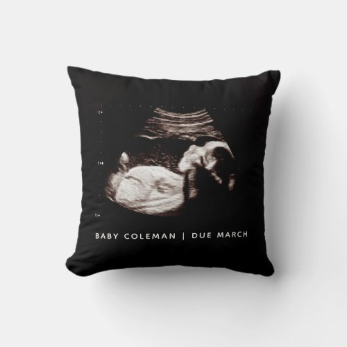 Pregnancy Announcement Baby Sonogram Photo Throw Pillow