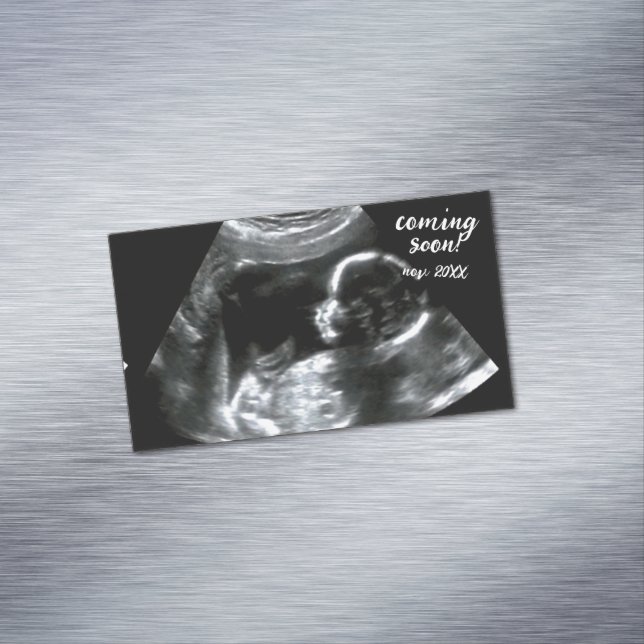 Pregnancy Announcement New Baby Scan Coming Soon  Business Card Magnet (In Situ)