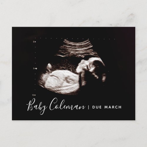 Pregnancy Announcement Sonogram Expecting Postcard