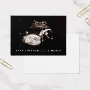Pregnancy Announcement Sonogram Mini Card Pack
