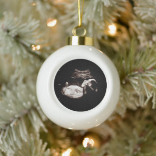Pregnancy Announcement Sonogram Ultrasound Photo Ceramic Ball Christmas Ornament
