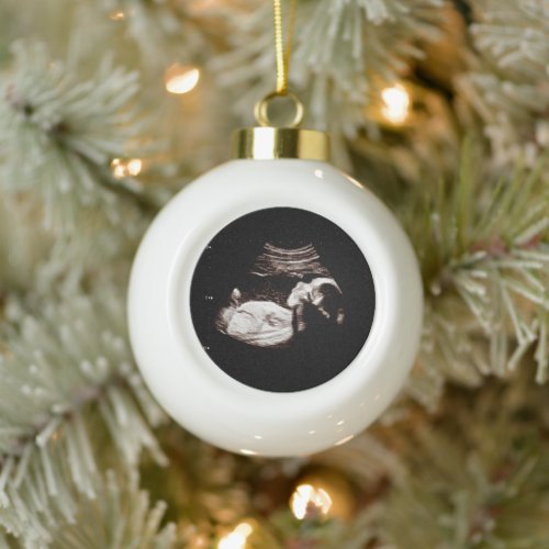 Pregnancy Announcement Sonogram Ultrasound Photo Ceramic Ball Christmas Ornament