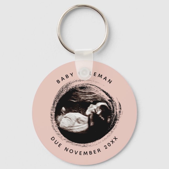 Pregnancy Baby Girl Sonogram Ultrasound Photo Pink Keychain (Front)