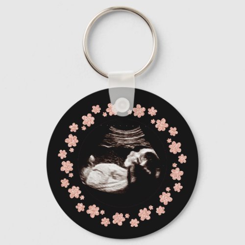 Pregnancy Baby Glitter Sonogram Ultrasound Photo Keychain