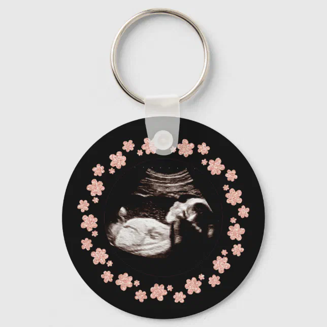 Pregnancy Baby Glitter Sonogram Ultrasound Photo Keychain | Zazzle