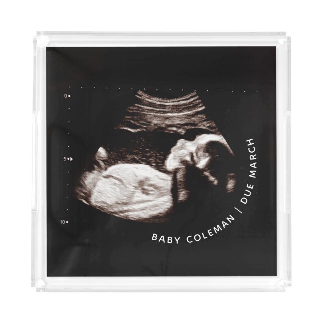 Pregnancy Baby Sonogram Ultrasound Photo Acrylic Tray (Front)