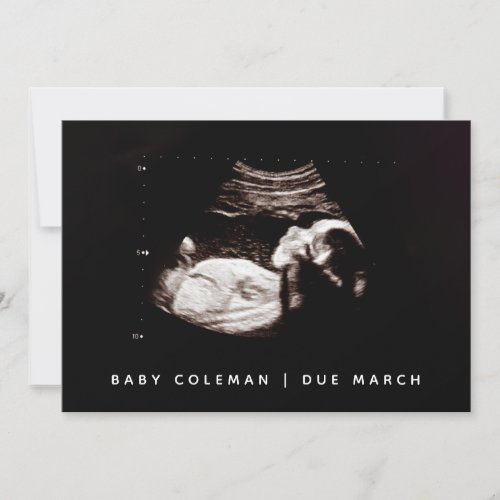 Pregnancy Baby Sonogram Ultrasound Photo Card