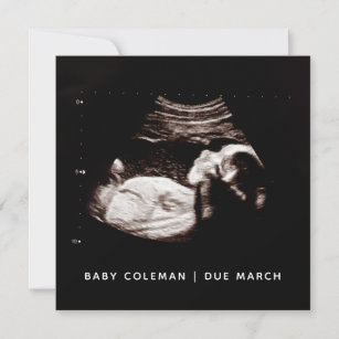 Pregnancy Baby Sonogram Ultrasound Photo Card