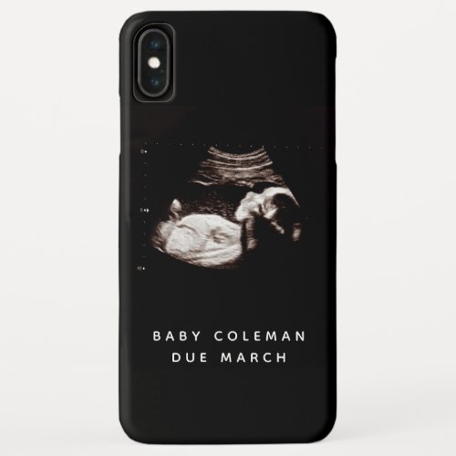 Pregnancy Baby Sonogram Ultrasound Photo iPhone XS Max Case