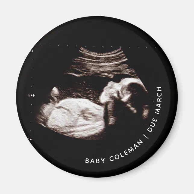 Sonogram Magnets Pregnancy Baby Sonogram Ultrasound Photo Magnet | Zazzle