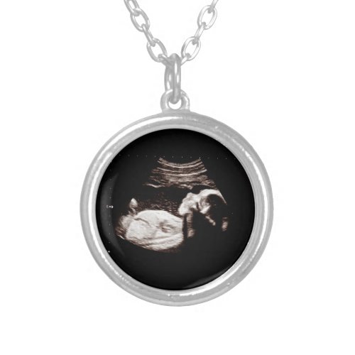 Pregnancy Baby Sonogram Ultrasound Photo Necklace