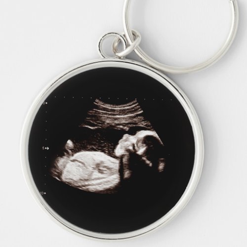 Pregnancy Baby Sonogram Ultrasound Photo New Mom Keychain