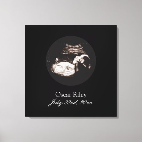 Pregnancy Baby Sonogram Ultrasound Photo Nursery Canvas Print