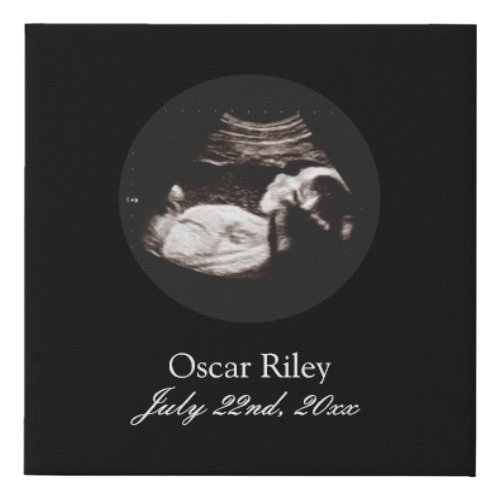 Pregnancy Baby Sonogram Ultrasound Photo Nursery Faux Canvas Print