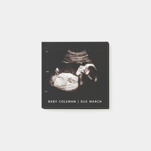 Pregnancy Baby Sonogram Ultrasound Photo Post_it Notes