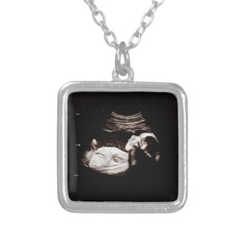 Pregnancy Baby Ultrasound Sonogram Photo Necklace