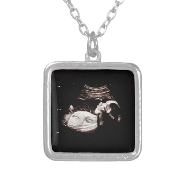 Pregnancy Baby Ultrasound Sonogram Photo Necklace (Front)