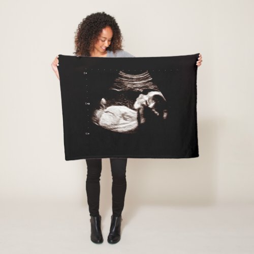 Pregnancy Keepsake Baby Ultrasound Sonogram Photo Fleece Blanket