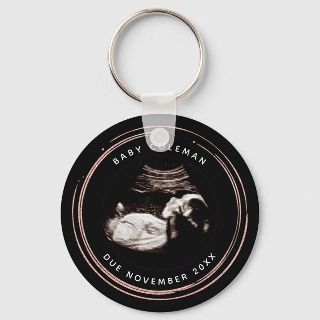 Pregnancy Pink Glitter Sonogram Ultrasound Photo Keychain (Front)
