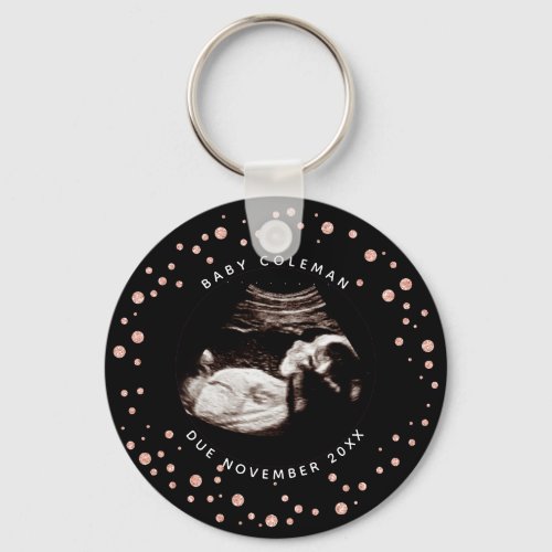 Pregnancy Pink Glitter Sonogram Ultrasound Photo Keychain