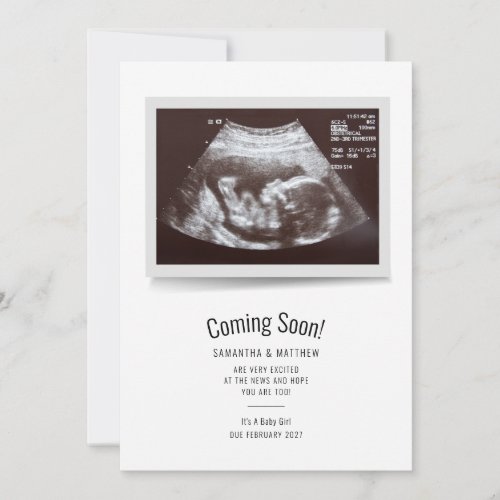 Pregnancy Scan Sonogram Baby Announcement