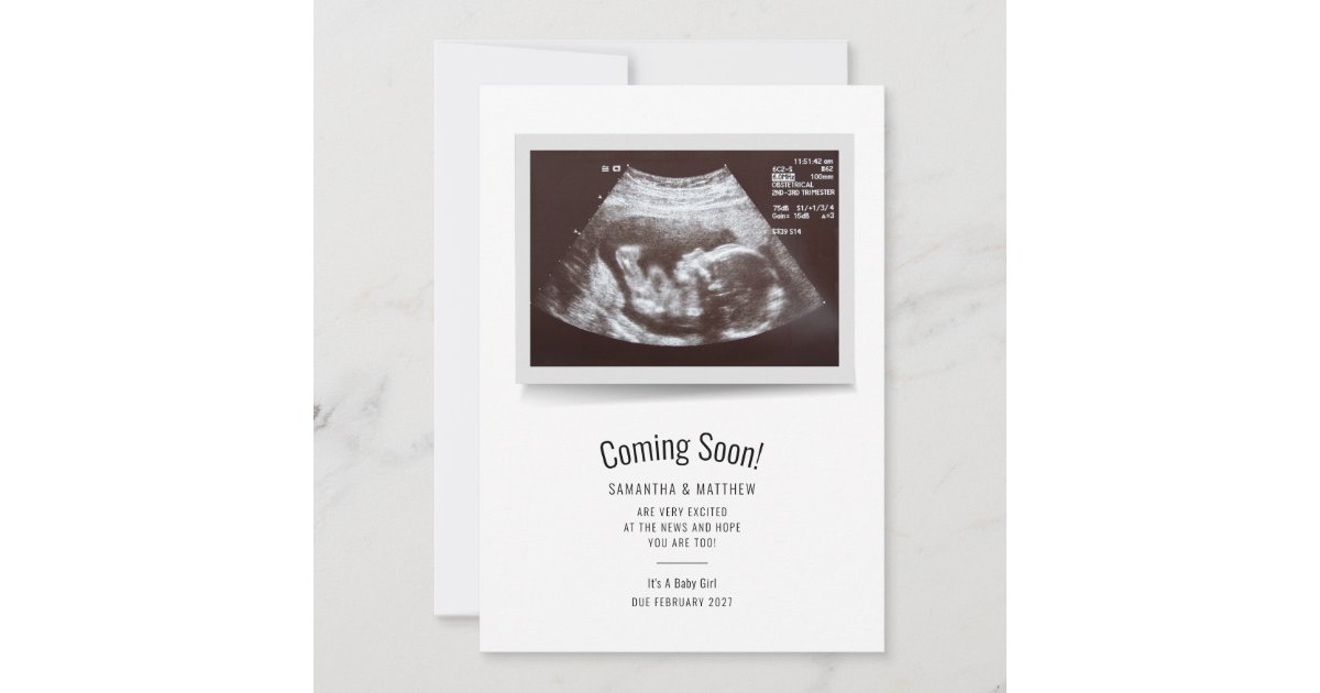 Personalised Scan Pregnancy Announcement Card / Baby Announcement + Envelope