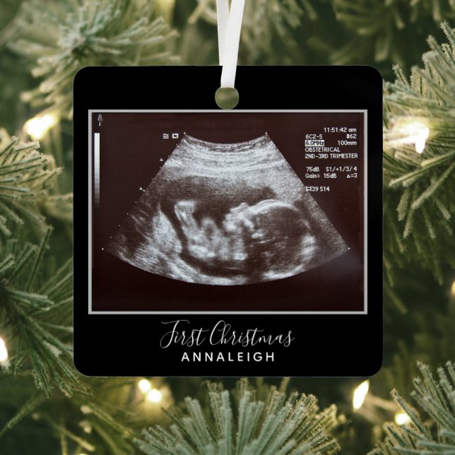 Pregnancy Ultrasound Photo First Christmas Holiday Metal Ornament (Insitu)