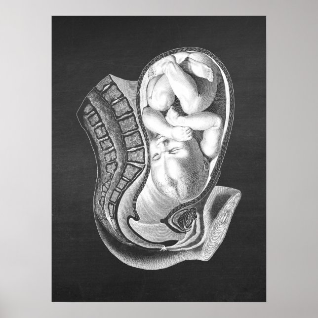 Pregnancy Womb Anatomy Obstetric Decor no.1 (Front)