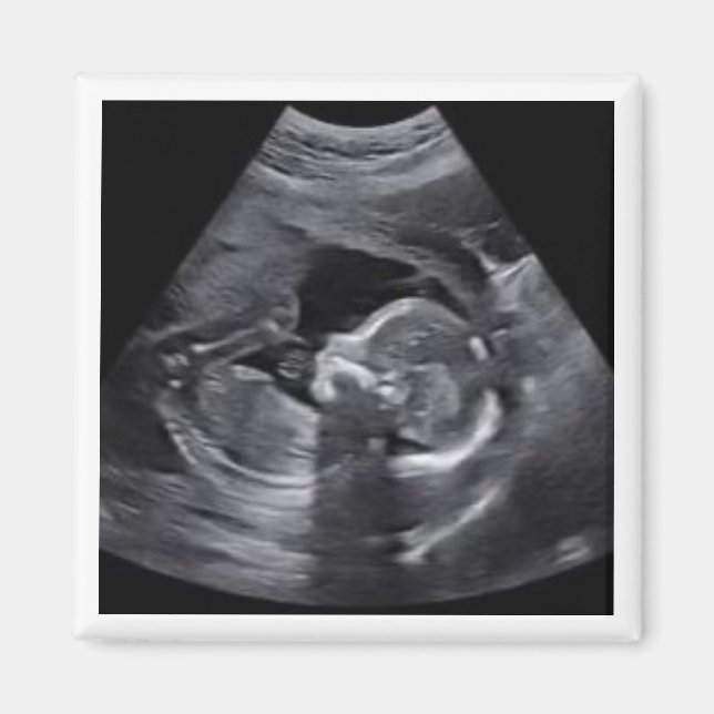 Pregnant Sonogram Photo Timeless Keepsake fun Magnet (Front)