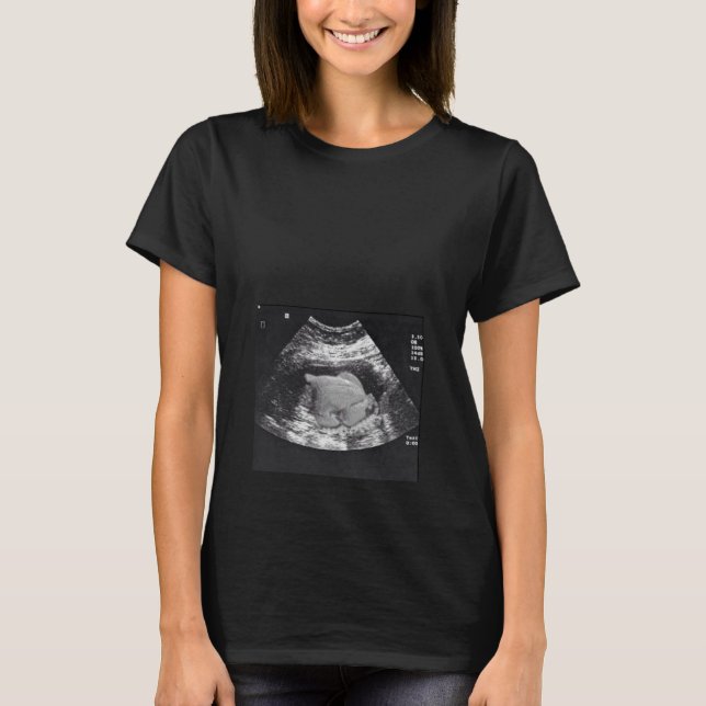PREGNANT TURKEY ULTRASOUND T-Shirt (Front)