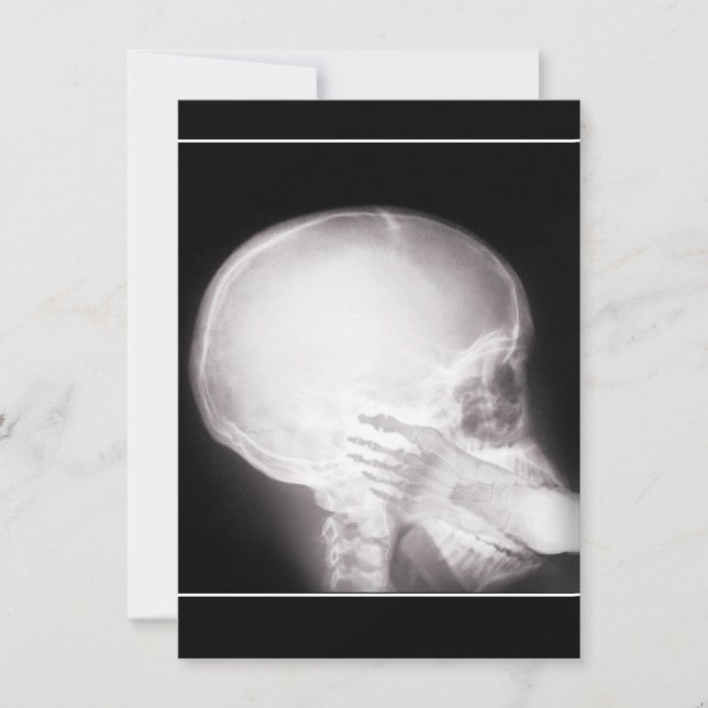 Prescription Invite w/Foot In Mouth X-ray (Front)