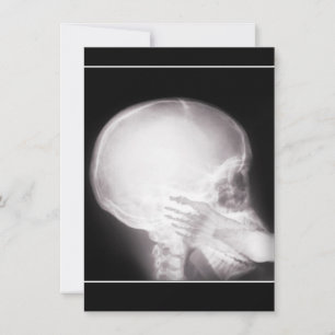 Prescription Invite w/Foot In Mouth X-ray