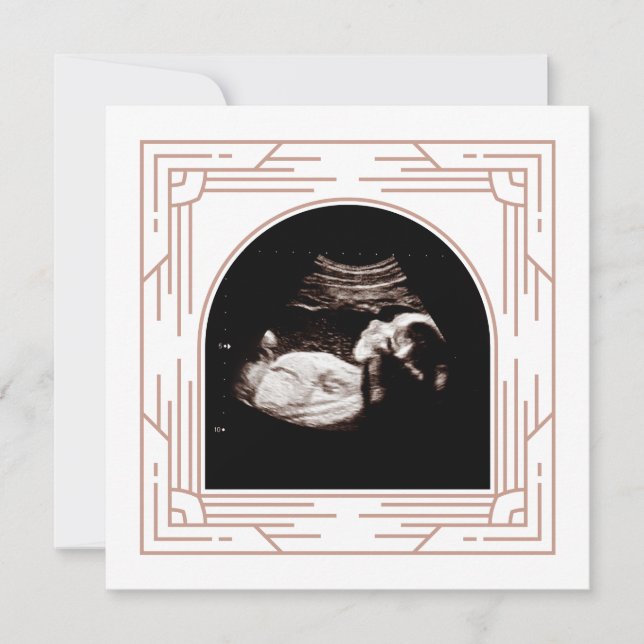 Pretty Pink Frame Baby Sonogram Photo  Announcement (Front)