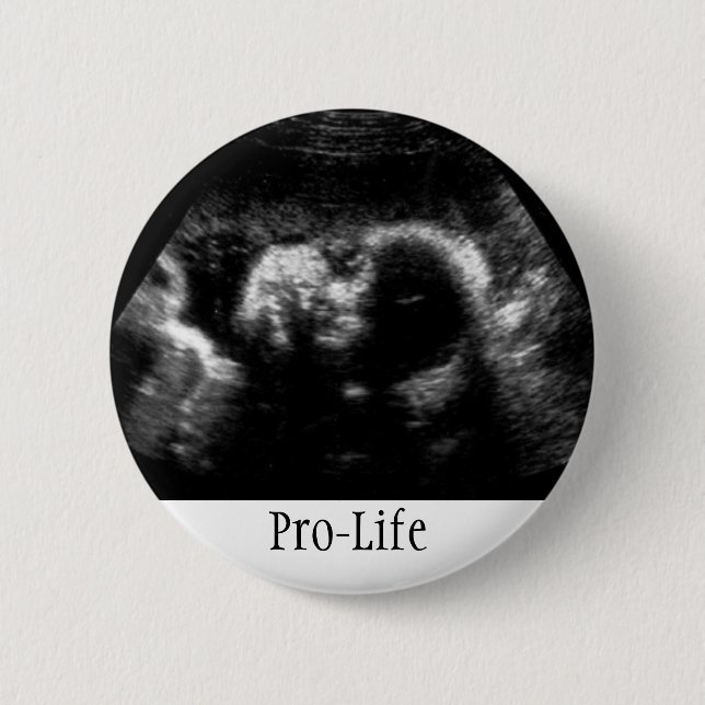 Pro-Life Pinback Button (Front)