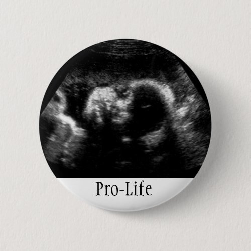 Pro_Life Pinback Button