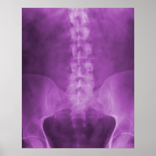 Purple Digital X_Ray Art Print