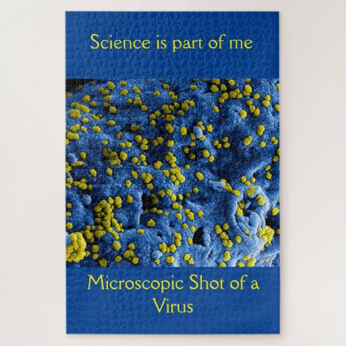 Puzzle imagen microscopia de un virus ciencia bio