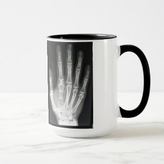 Queen in the Hand X-ray Mug