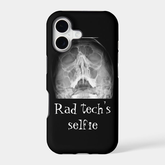 Rad tech selfies iphone case (Back)