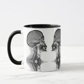 Radiological mug