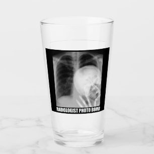 RADIOLOGIST PHOTO BOMB GLASS