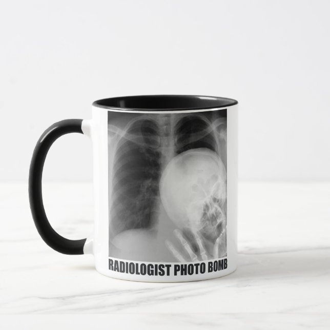 RADIOLOGIST PHOTO BOMB MUG (Left)