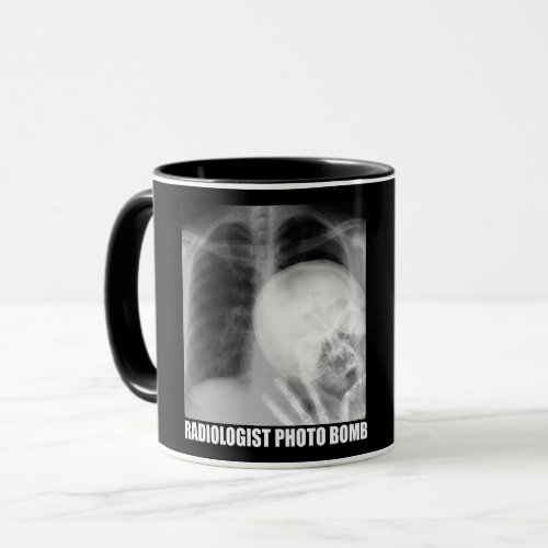 RADIOLOGIST PHOTO BOMB MUG