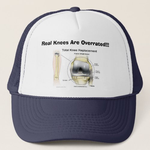 Real Knees Are Overrated Trucker Hat