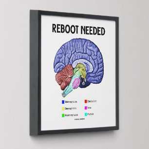 Reboot Needed Brain Anatomy Geek Humor Peel And Stick Photo Tile