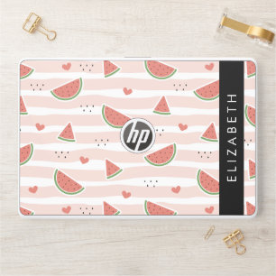 Red Watermelons, Hearts, Stripes, Your Name HP Laptop Skin