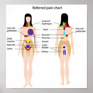 Referred pain chart Poster