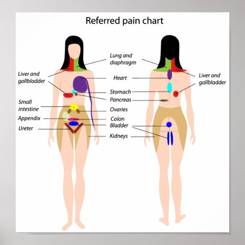 Referred pain chart Poster