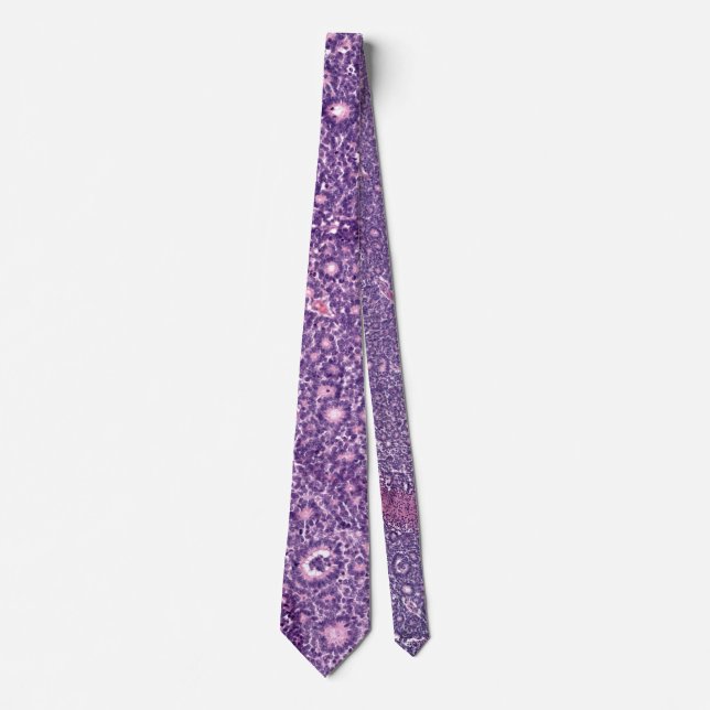 Retinoblastoma Neck Tie (Front)